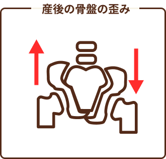 産後の骨盤の歪み